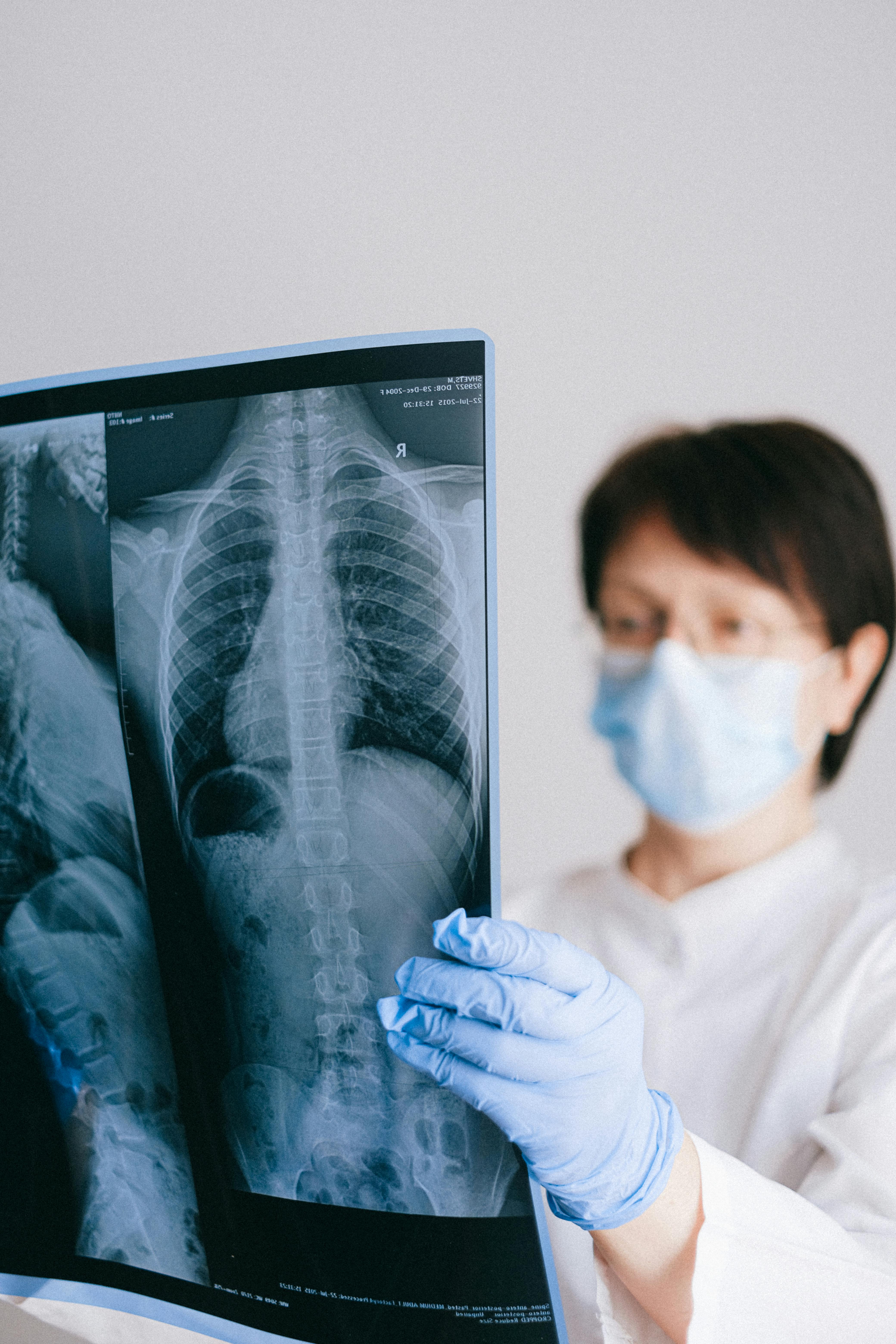 Digital X-rays